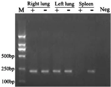 Case Study: Strand-Specific Identification of Influenza A Virus Replication in an Immunocompromised Patient